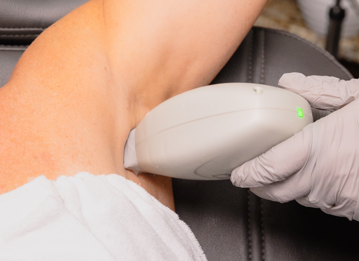 Close-up of a woman receiving laser hair removal in OKC to her underarms at Elysian Wellness & Aesthetics.